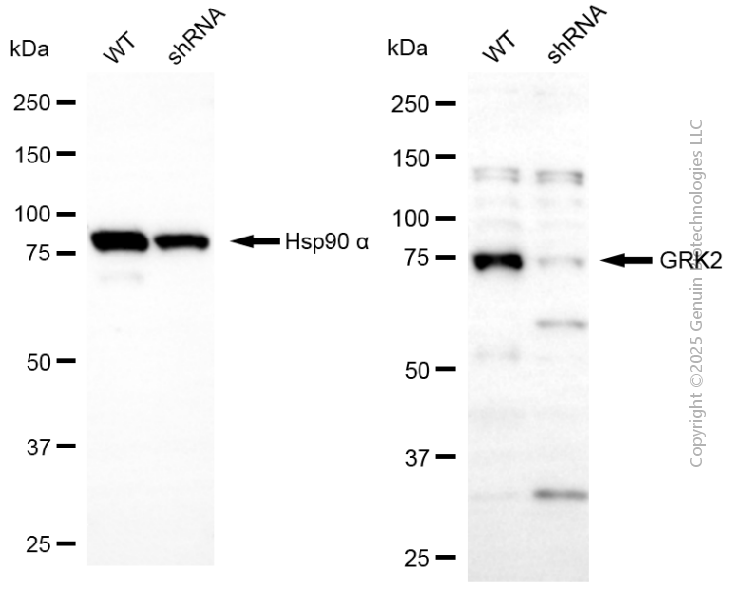 WB - KD-Validated Anti-GRK2 Rabbit Polyclonal Antibody AGI2114